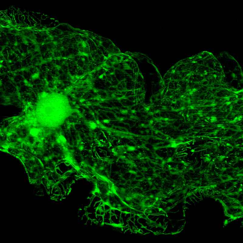 What is the Endoplasmic Reticulum?