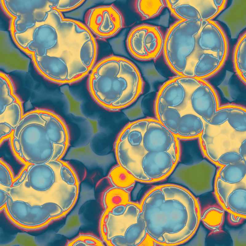 How Are Bacterial Cells Different From Plant & Animal Cells?