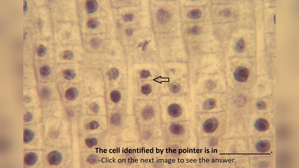 Does Mitosis Occur in Root Tips in Plants? Clear Answer